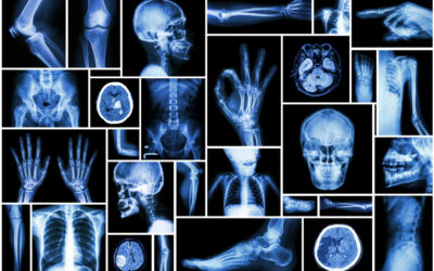 ORGANISATION TEMPORAIRE DES EXAMENS DE RADIOLOGIE :